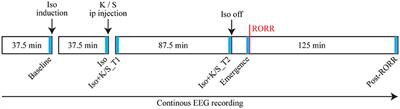 Accelerated Recovery of Consciousness after General Anesthesia Is Associated with Increased Functional Brain Connectivity in the High-Gamma Bandwidth